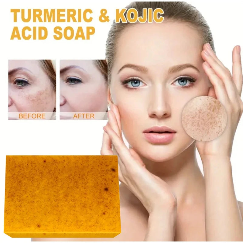 Turmeric & Lemon Whitening Soap - Handmade